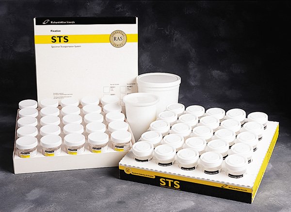 Prefilled Formalin Container SP® 15 mL Fill in 30 mL (1 oz.) Screw Cap Biohazard Symbol / Patient Information NonSterile