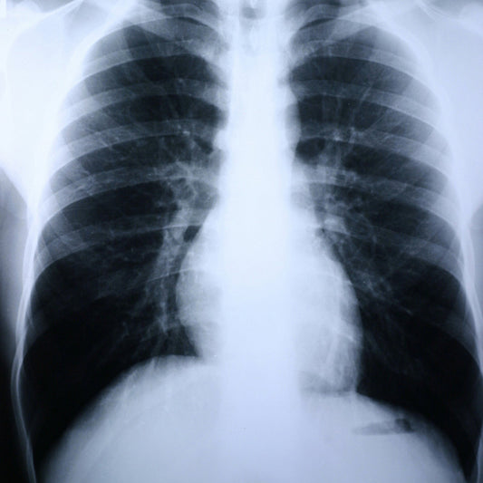X-Ray Film Clear Choice™ Performance 8 X 10 Inch Medium Speed Green Sensitive High