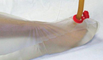 Post Mortem Unionall Mort-Port™ 2X-Large PVC Zipper Closure, 1/2 Length