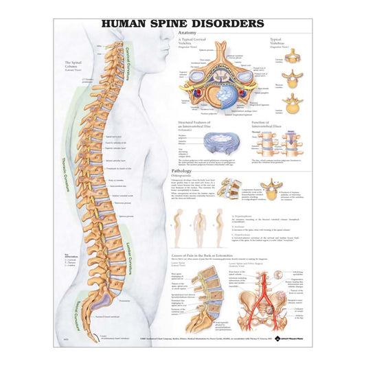 Anatomical Chart Human Spine Disorders 20 X 26 Inch Plastic Wall Mount Laminated