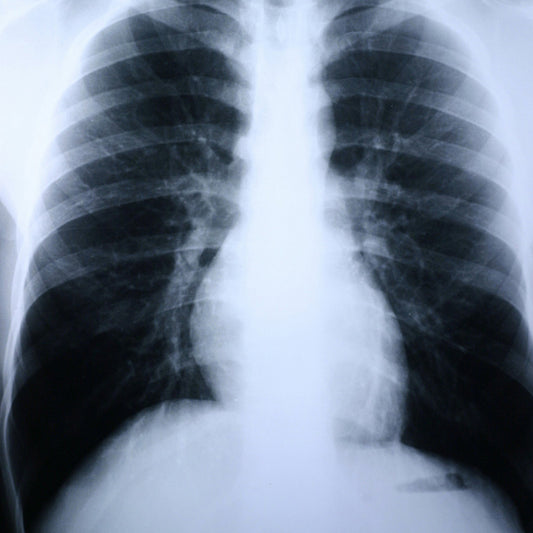 X-Ray Film Clear Choice™ Performance 8 X 10 Inch High Speed Blue Sensitive High